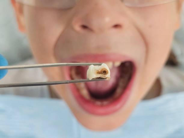 Best Emergency Treatment for Jaw Pain or Injury in Vincent, CA